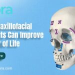 How Maxillofacial Implants Can Improve Quality of Life?